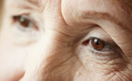 Две операции по удалению катаракты привели к синдрому Ирвина-Гасса