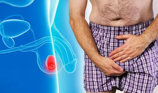 Рак яичек у мужчин: симптомы заболевания при локализованном процессе